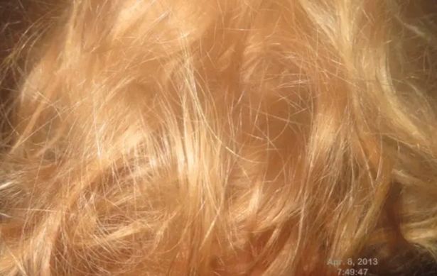 Chilling photo of the top of Kris's head taken seven days after they disappeared. 5 Scary Facts About the Deaths of Dutch Hikers Kris Kremers and Lisanne Froon in Panama.